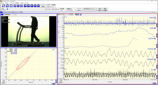 BIMUTAS-Video for ECG̃C